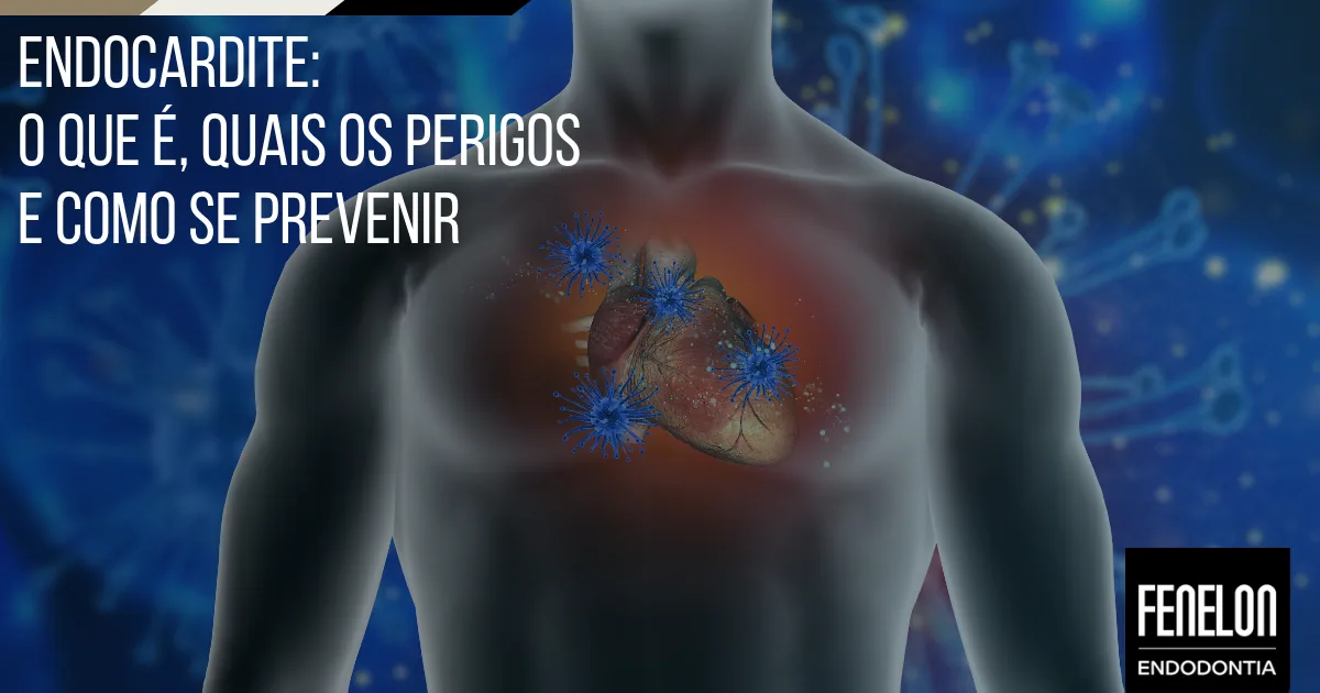 Endocardite: o que é, quais os perigos e como se prevenir