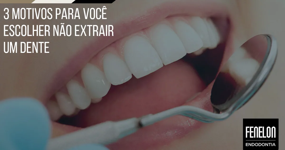 3 motivos para você não extrair um dente