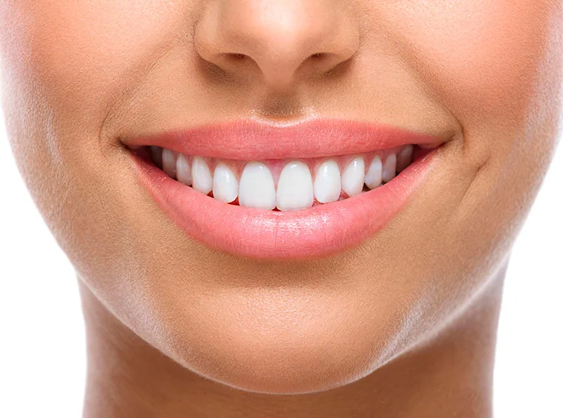 Sorriso em tratamento a laser na odontologia